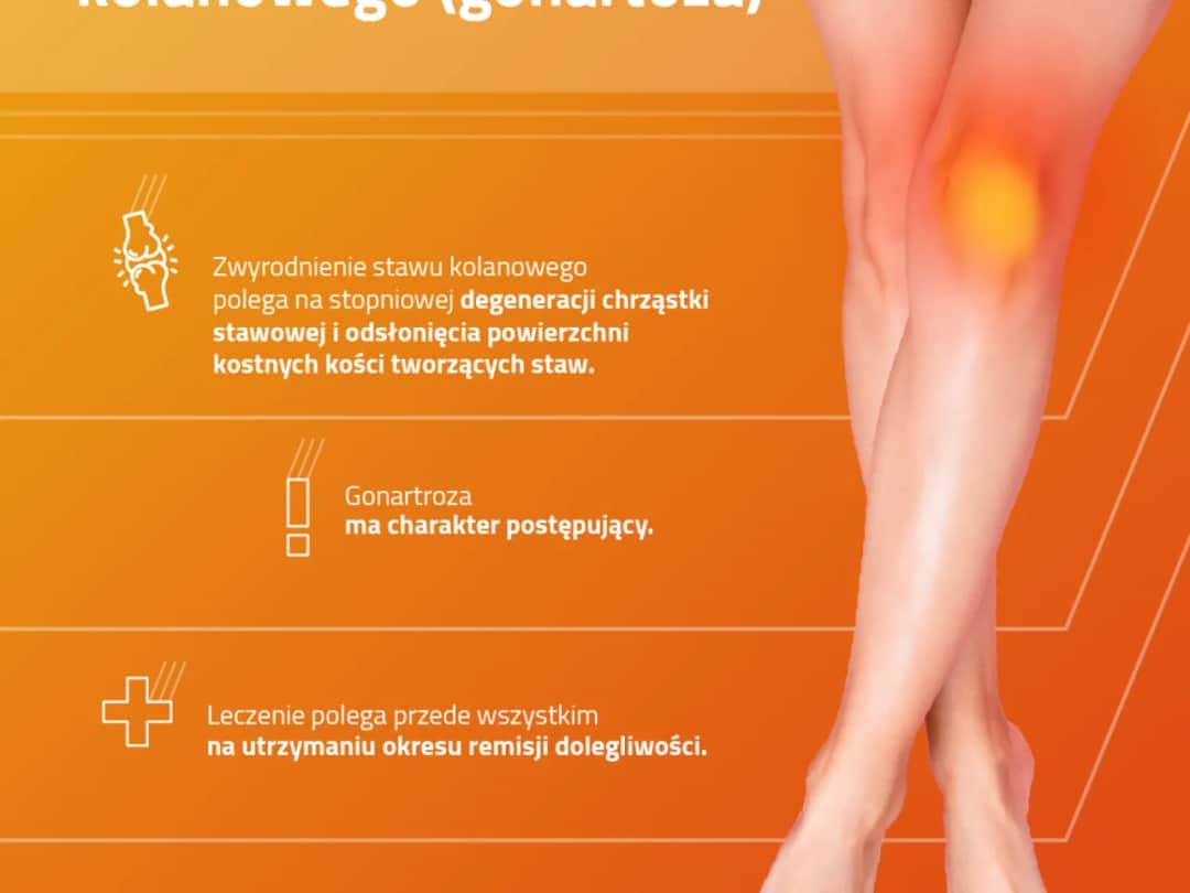 Jakie są objawy naciągniętego kolana? Lista najważniejszych symptomów