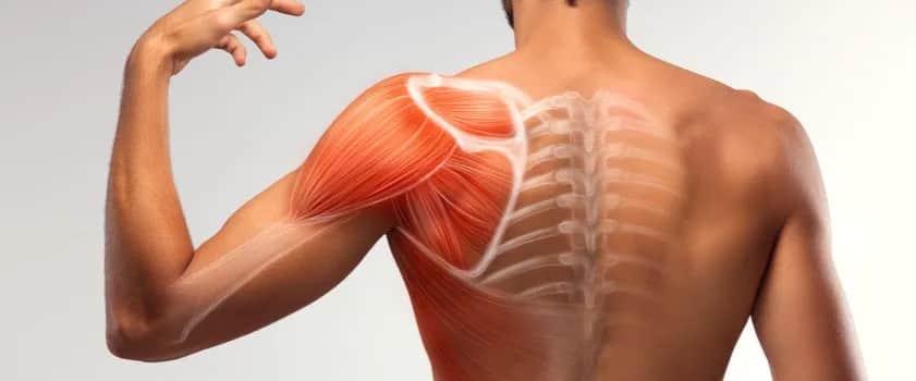 Naciągnięcie mięśnia barku: rozpoznaj objawy i zacznij skuteczne leczenie