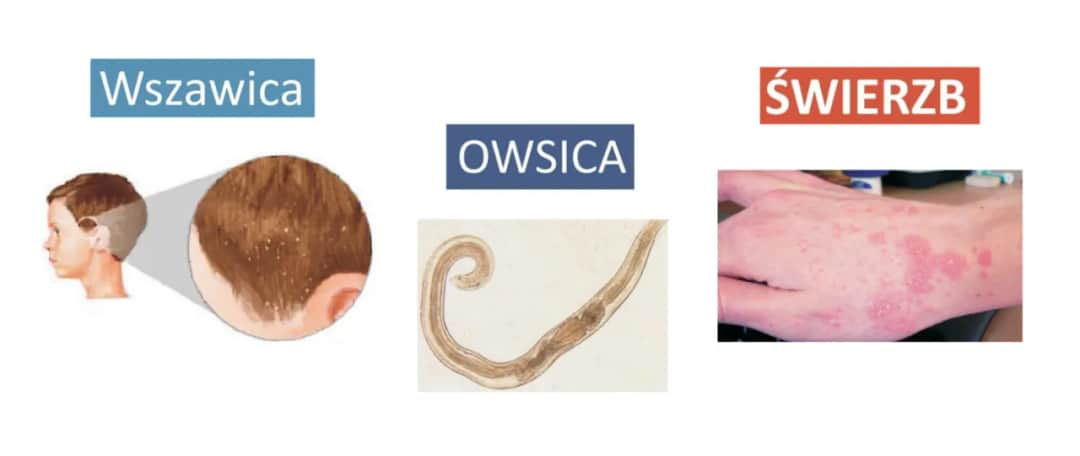 Najczęstsze objawy owsicy: poznaj 6 niepokojących sygnałów choroby