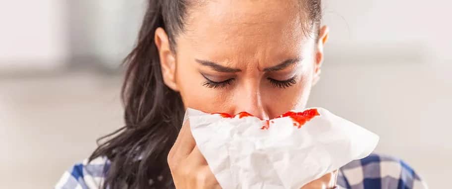 Krwawienia z nosa przyczyna: najczęstsze powody i jak im zapobiegać