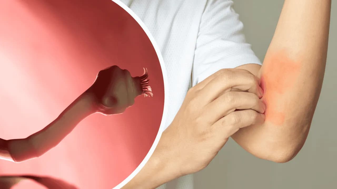 Niepokojące objawy tasiemca u człowieka: lista najważniejszych symptomów