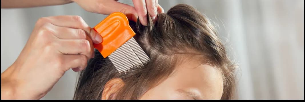 Skuteczne sposoby na zapobieganie wszawicy u dzieci - uniknij problemu!