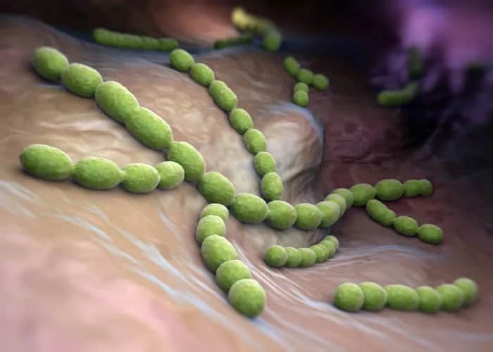 Niebezpieczne objawy sepsy - poznaj sygnały alarmowe i reaguj od razu