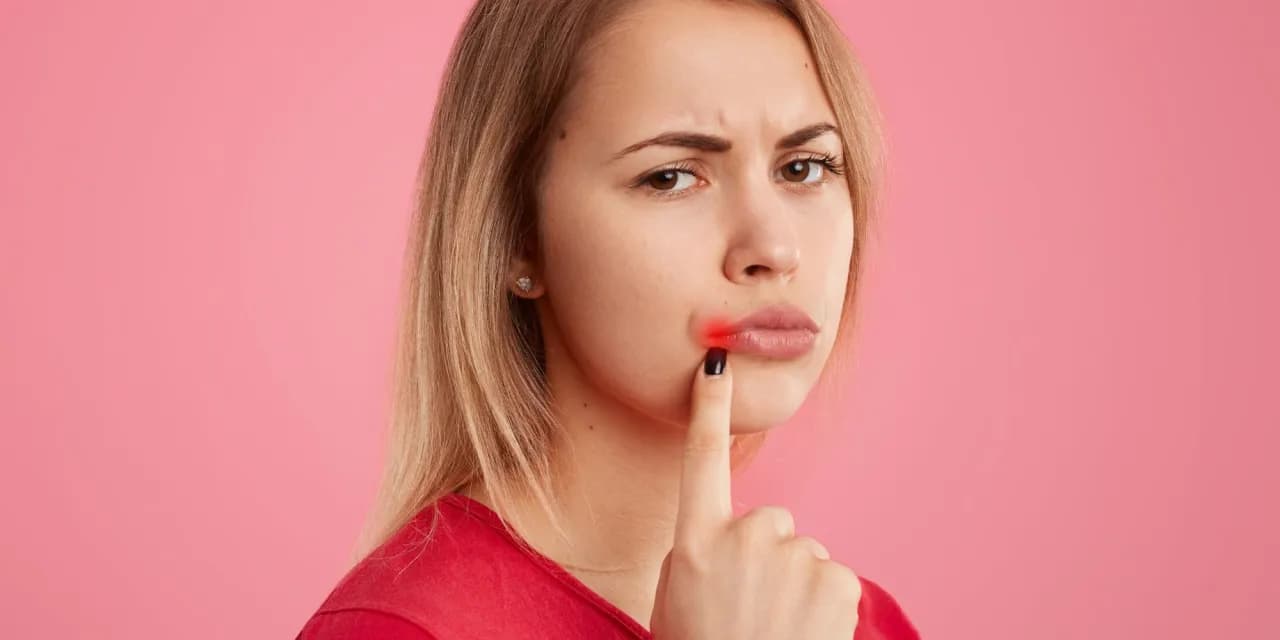 Jak zapobiec opryszczce? Najlepsze metody na uniknięcie zakażenia
