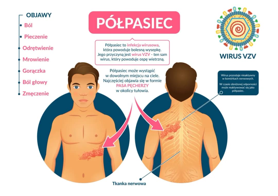 Najczęstsze objawy półpaśca - poznaj pierwsze niepokojące sygnały choroby
