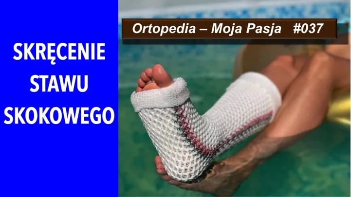 Skręcenie stawu skokowego - gips czy orteza, co wybrać dla zdrowia?