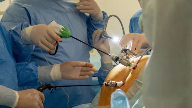 Czy laparoskopia jest refundowana przez NFZ? Sprawdź, co musisz wiedzieć