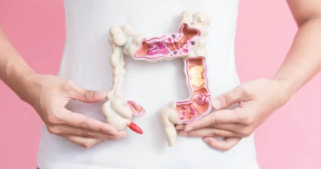 Poznaj najważniejsze objawy raka jelita grubego: 8 sygnałów ostrzegawczych