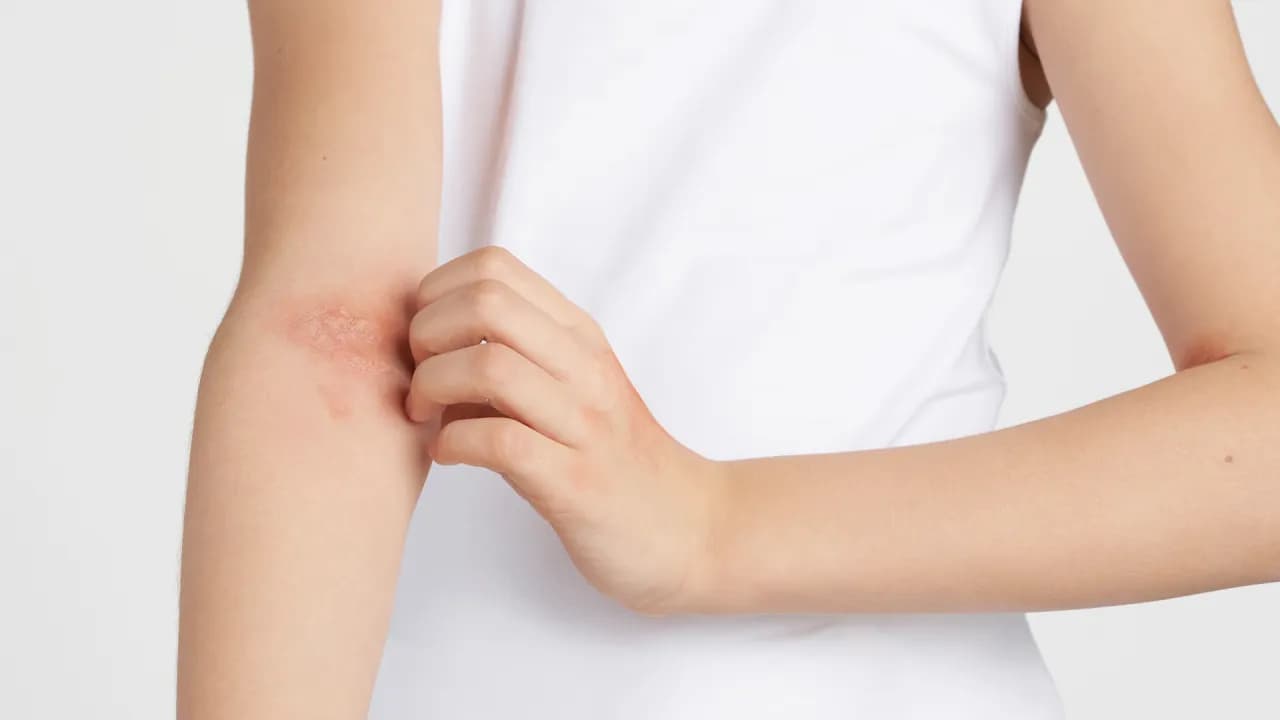 Swędzenie skóry – poznaj przyczyny i objawy, które mogą zaskoczyć