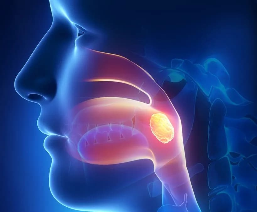 Gdzie najszybciej wyciąć migdałki NFZ? Sprawdź najlepsze opcje