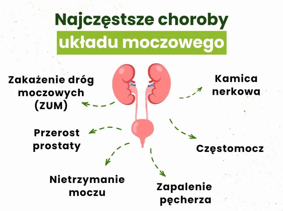 Najczęstsze objawy zapalenia pęcherza - na co zwrócić uwagę u siebie