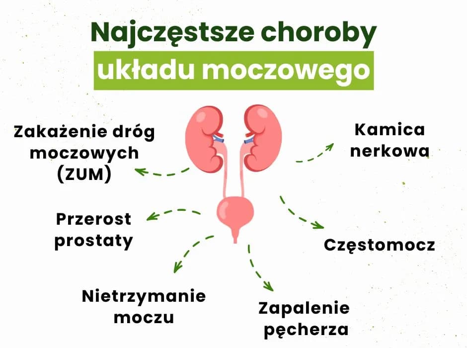 Najczęstsze objawy zapalenia pęcherza - na co zwrócić uwagę u siebie