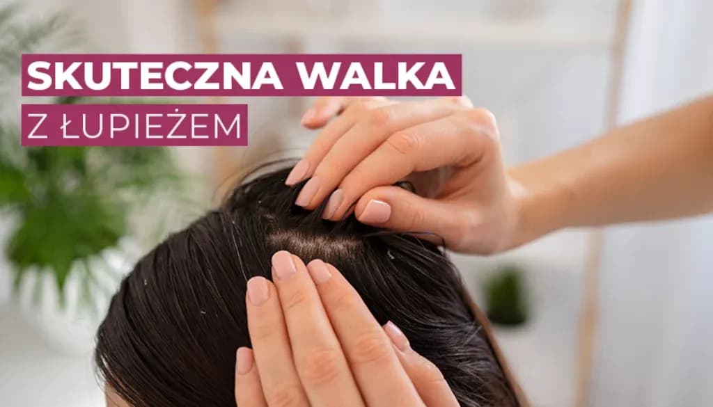 Skąd się bierze łupież? Przyczyny, objawy i skuteczne metody walki