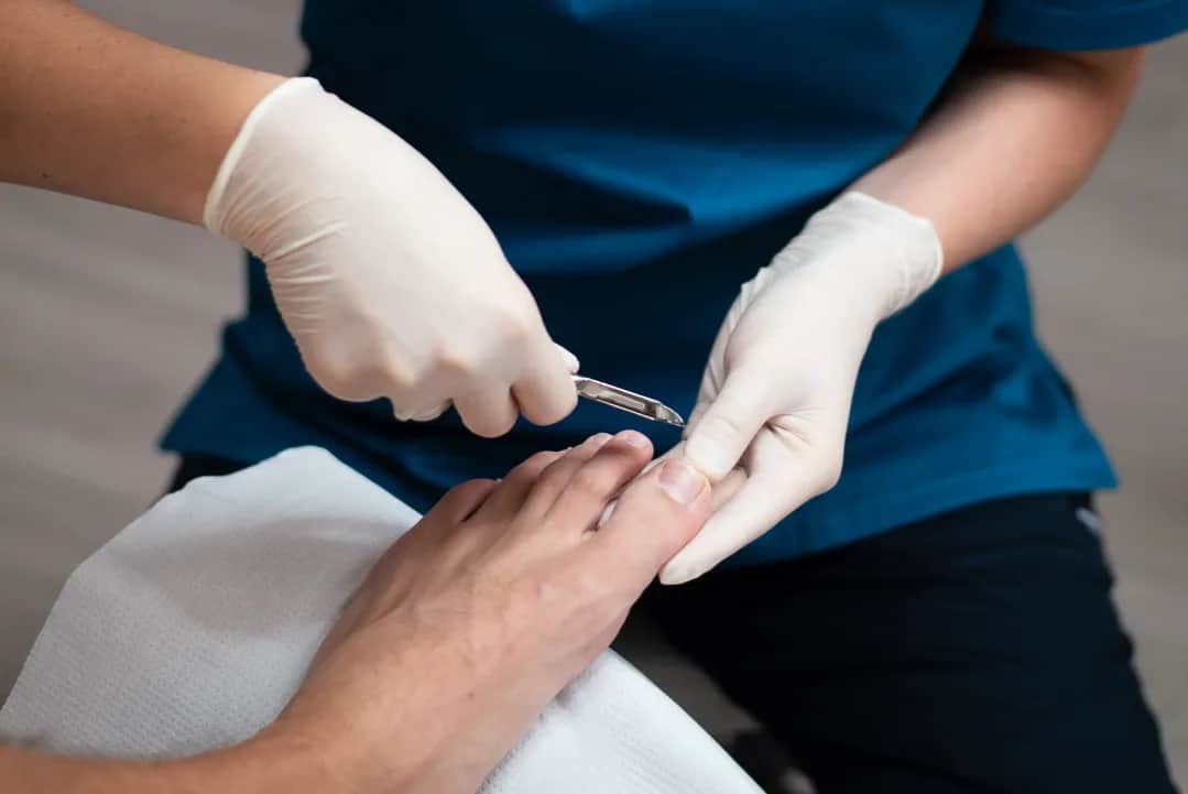 Masz problem z bólem stóp lub wrastającymi paznokciami? Zobacz, co poleca sprawdzony sklep podologiczny